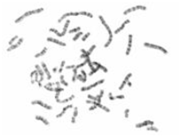 Human iPS Metaphase