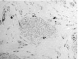 Rat iPS Cell